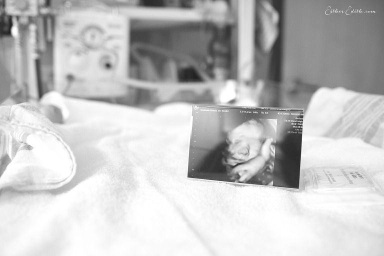 Colfax birth photographer, Spokane Birth Photography, Spokane doula, washington birth photographers, birth photos, newborn photos, professional birth photography, the birth of clay dennis,